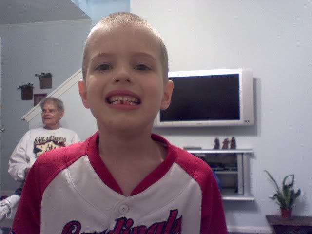 Matthew lost a tooth!